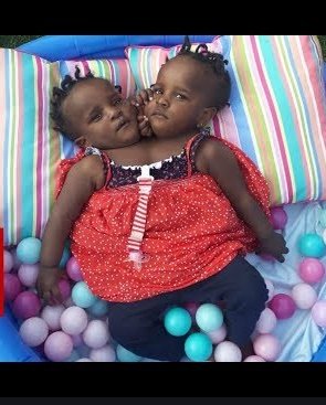 Les jumelles siamoises Marieme et Ndeye. | Photo:YouTube/BBC News