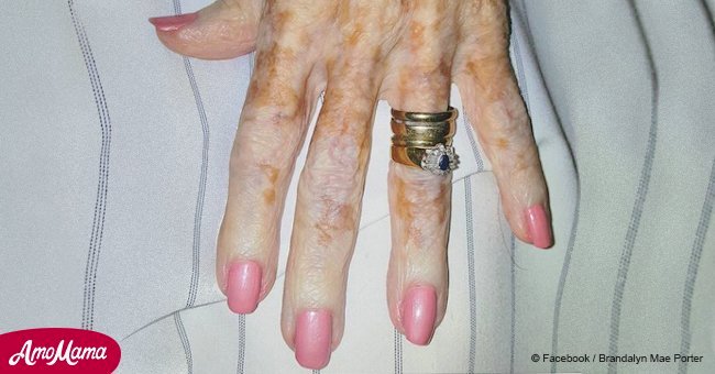 Une infirmière peint les ongles d'une vieille dame et partage la photo