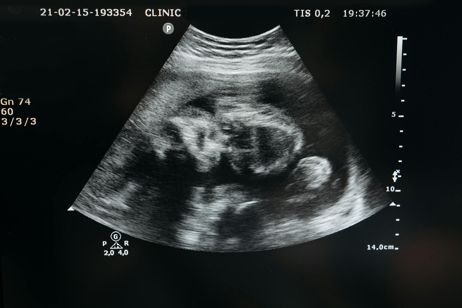 Une échographie d'un bébé à naître | Source : Pexels